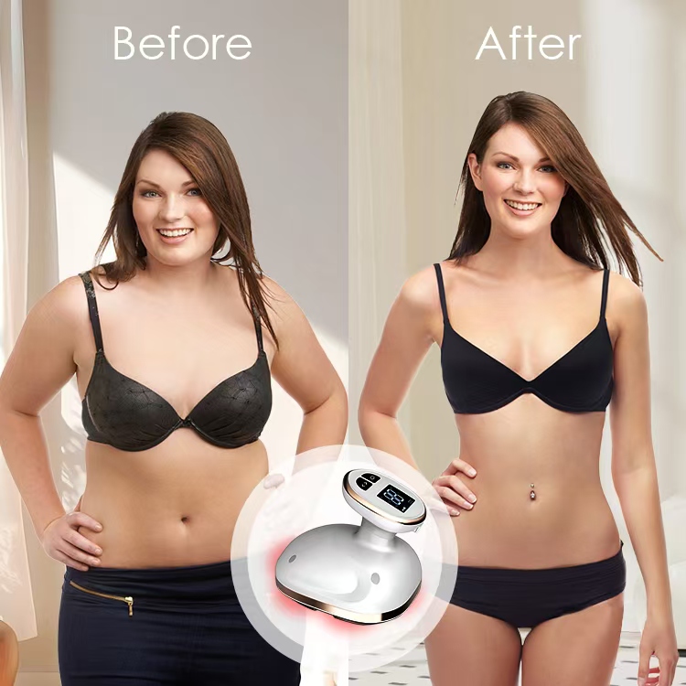 Body Shaping Machine Stretch Mark Massager Tightening Device Body Shaping Machine Stretch Mark Massager Tightening Device